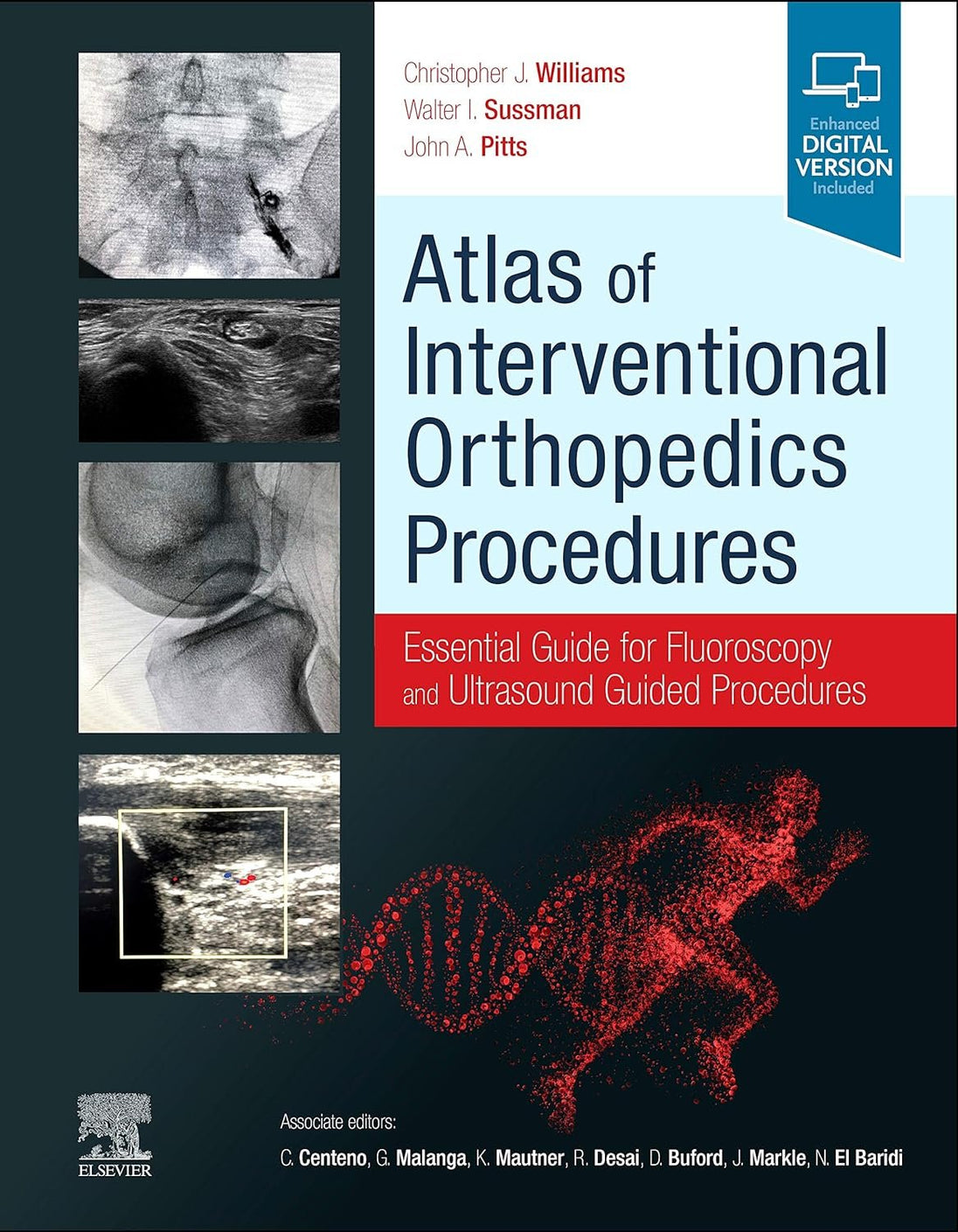 ATLAS OF INTERVENTIONAL ORTHOPEDICS PROCEDURES: ESSENTIAL GUIDE FOR FLUOROSCOPY AND ULTRASOUND GUIDED PROCEDURES - Paramount Books   