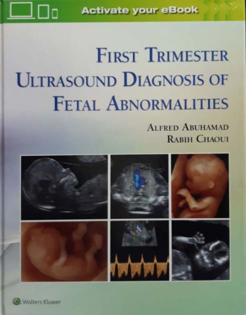 FIRST TRIMESTER ULTRASOUND DIAGNOSIS OF FETAL - Paramount Books   