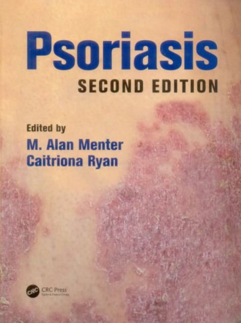 PSORIASIS - Paramount Books   