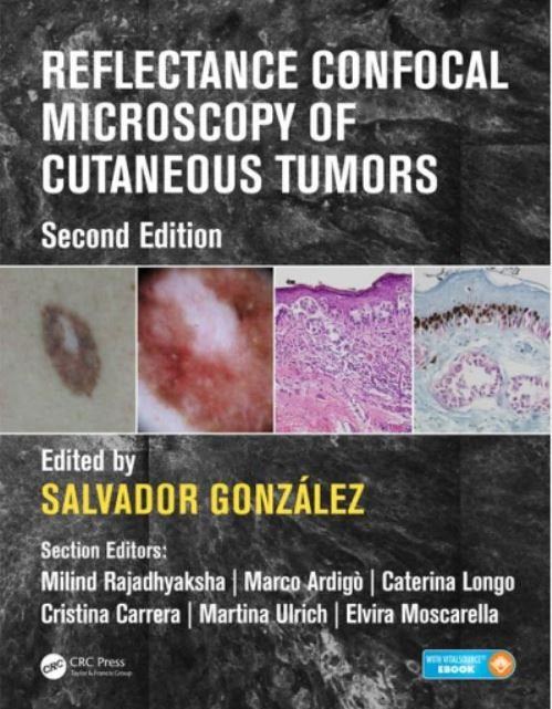 REFLECTANCE CONFOCAL MICROSCOPY OF CUTANEOUS TUMORS - Paramount Books   