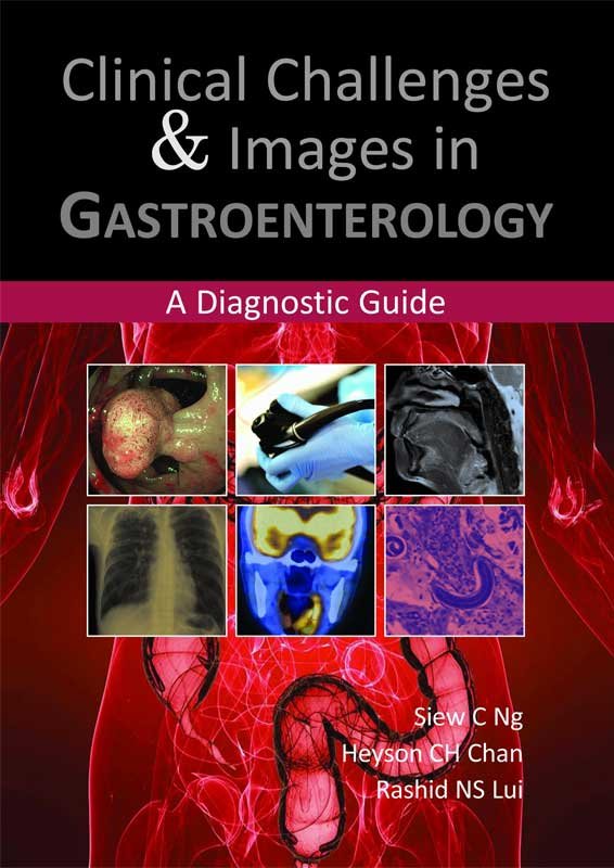 CLINICAL CHALLENGES & IMAGES IN GASTROENTEROLOGY
