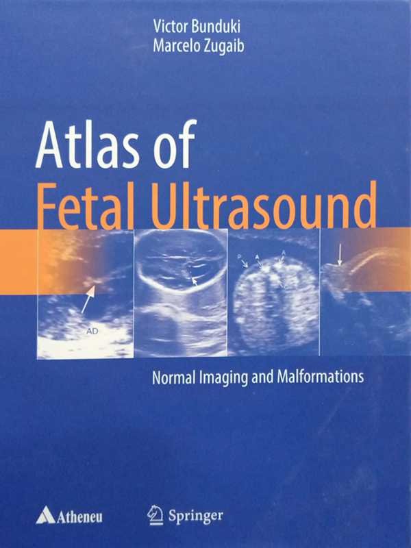 ATLAS OF FETAL ULTRASOUND - Paramount Books   