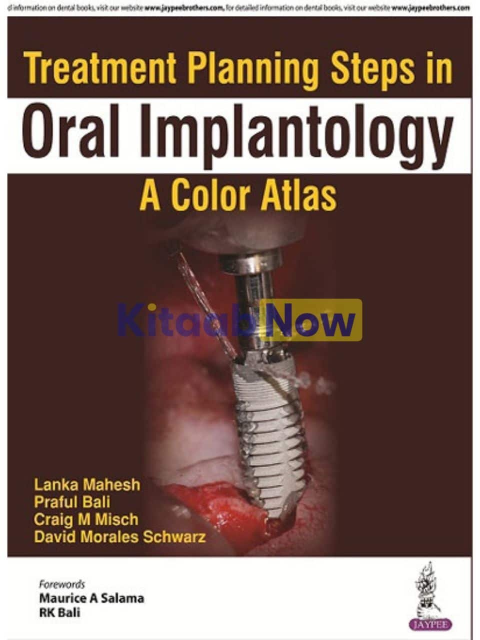 TREATMENT PLANNING STEPS IN ORAL IMPLANTOLOGY: A COLOR ATLAS - Paramount Books   