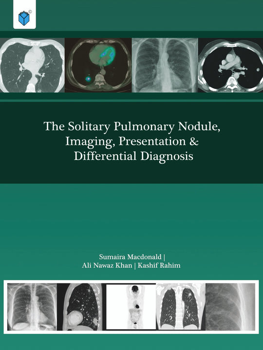 THE SOLITARY PULMONARY NODULE,IMAGING,PRESENTATION & DIFF DIAGNOSIS - Paramount Books   