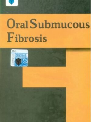 Oral Submucous Fibrosis Relief Spray bottle with natural ingredients including Aloe Vera, Licorice Root, and Turmeric.