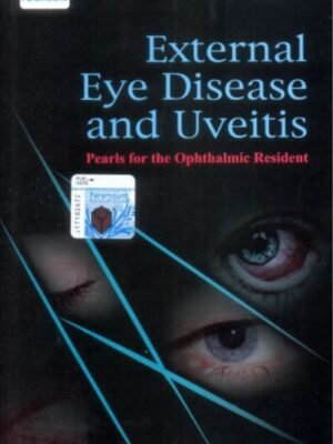 Comprehensive manual on uveitis and external eye disease for ophthalmology residents. Find important nuggets of knowledge to advance your knowledge. Alt text: A resident in ophthalmology studying uveitis and exterior eye illnesses