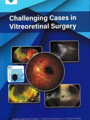 Challenging Cases in Vitreoretinal Surgery